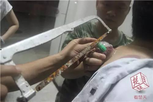 男生成人拔罐视频-第3张图片-亚洲AV中文无码乱人伦