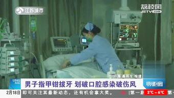 成人自己拔牙视频大全,视频大全揭秘-第2张图片-亚洲AV中文无码乱人伦